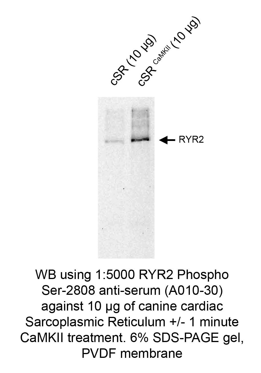 Ryanodine receptor 2 (RYR2) (pSer2808) pAb serum