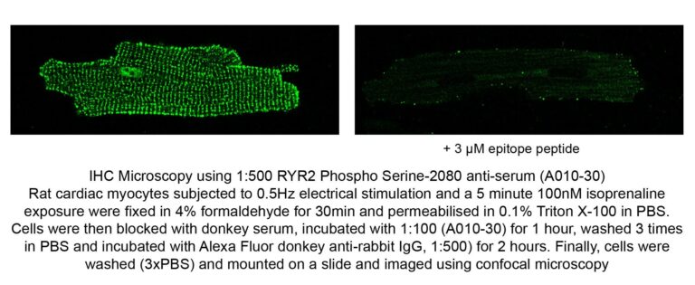Ryanodine receptor 2 (RYR2) (pSer2808) pAb serum
