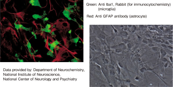 Anti Iba1, Rabbit (for Immunocytochemistry) – 亞旭生物科技