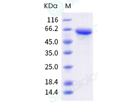 Influenza A H3N2 (A/Darwin/9/2021) Neuraminidase / NA Protein (ECD, His Tag)