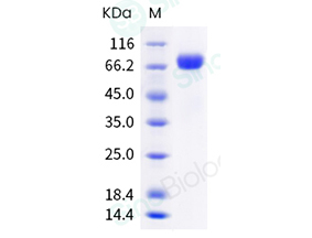 Influenza B (B/Austria/1359417/2021) Hemagglutinin / HA Protein (ECD, His Tag)