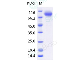 Influenza B (B/Austria/1359417/2021) Hemagglutinin / HA Protein (ECD, His Tag)