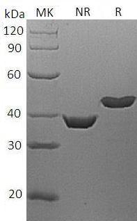 Human LEFTY2/EBAF/LEFTA/LEFTYA (His tag) recombinant protein