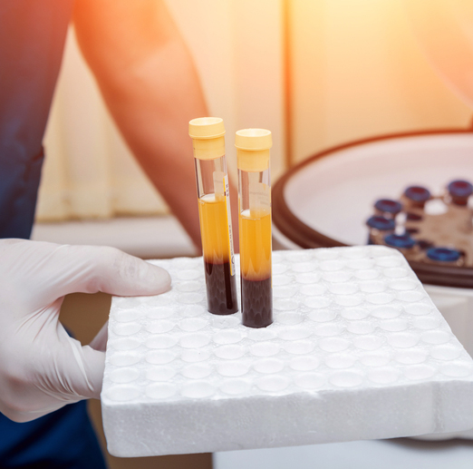 Yellow Fever Virus Vaccine Serum: Vaccination Time-Course Panel